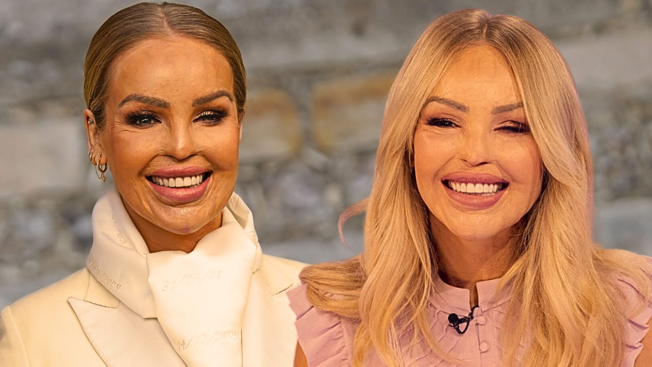Katie Piper is back on track with “Loose Women.”